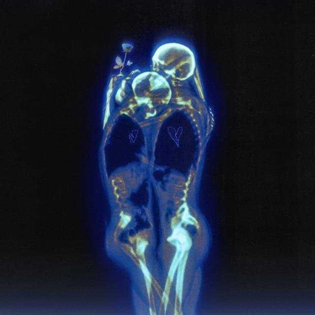 Cover della canzone 'CHIARA' di Rondodasosa