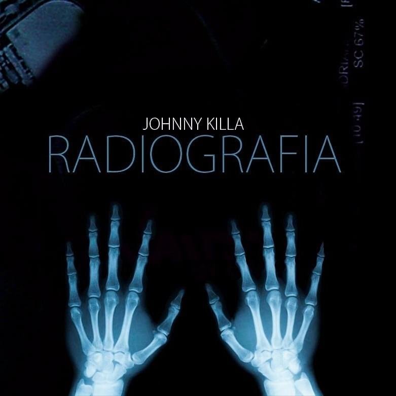 Cover dell'album 'Radiografia - EP' di Johnny Marsiglia